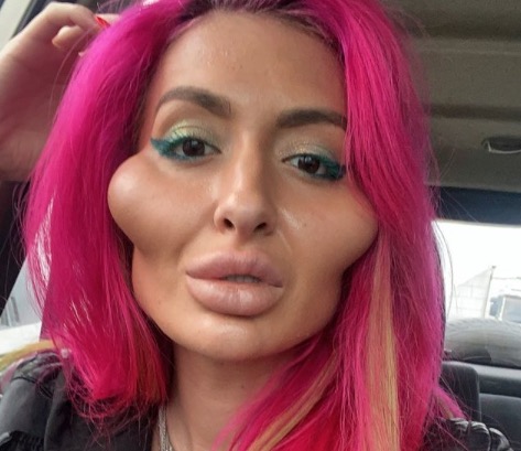 Украинка прославилась в мире из-за больших скул: наколола их сама