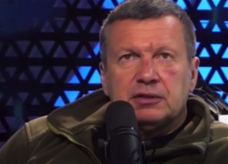 "Тревожно мне": расстроенный Соловьев "засветился" с синяками на лице (видео)