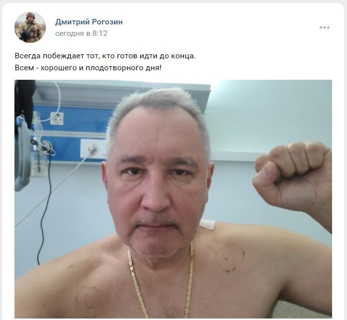 Раненный в Донецке Рогозин опубликовал первое фото из больницы