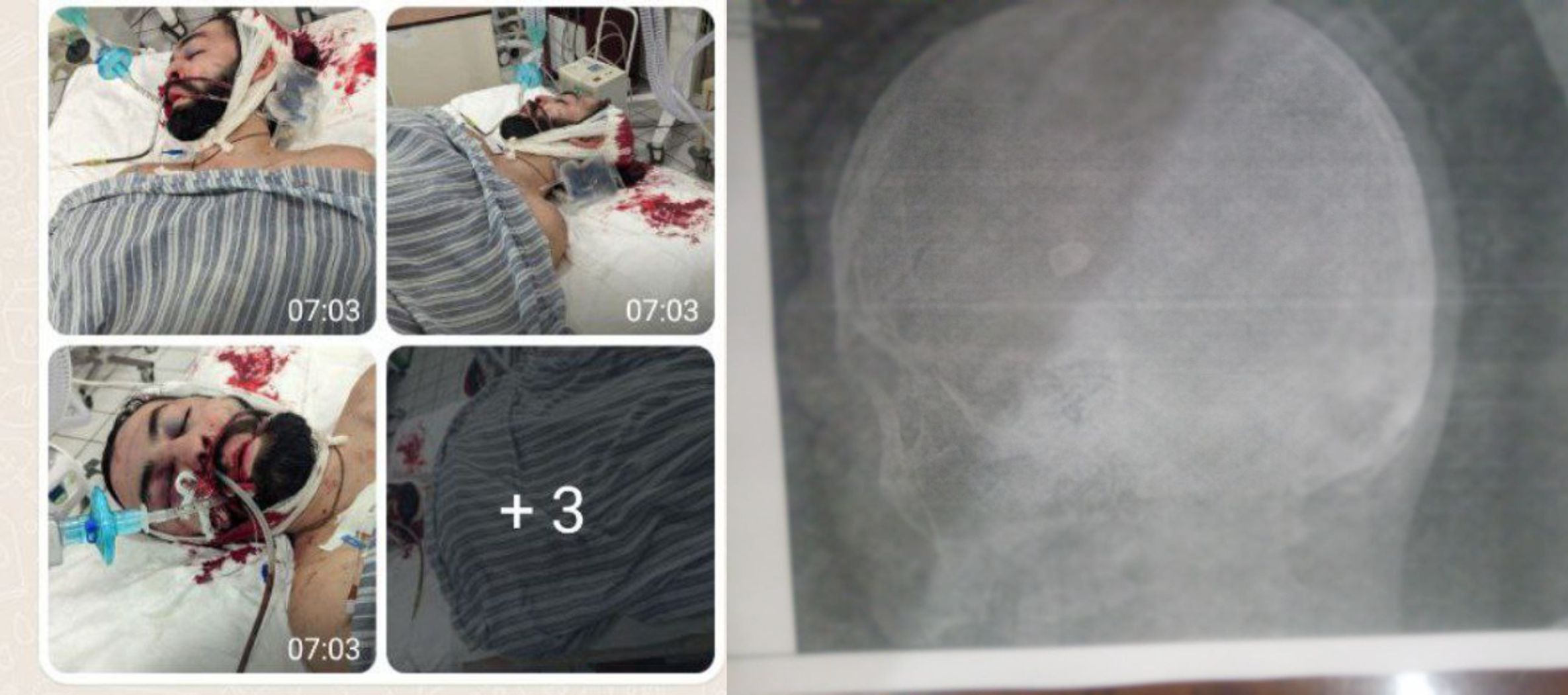 Жена неонациста, капитана ВС РФ Мангушева заявила, что над ним свои устроили расправу в тылу